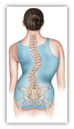 spine scoliosis treatment