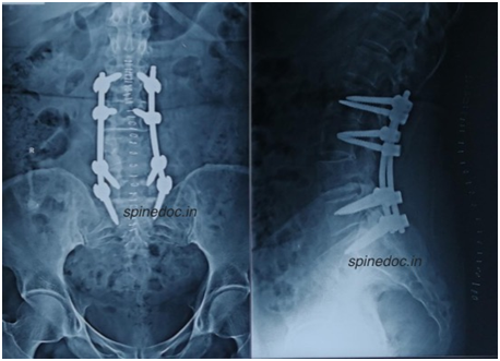 surgical-procedure