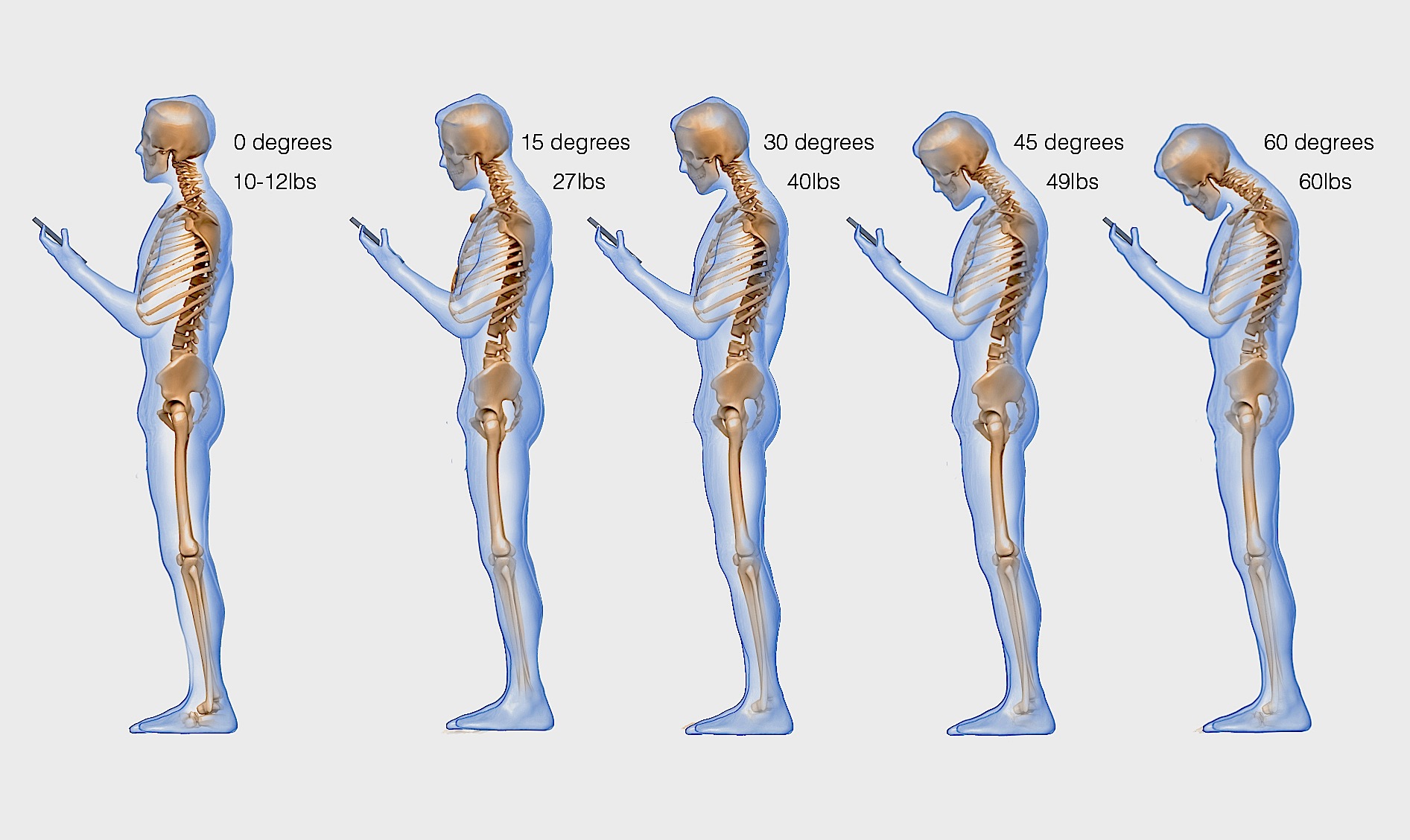 How Smartphone Use Is Affecting Your Spine How Smartphone Use Is Affecting Your Spine