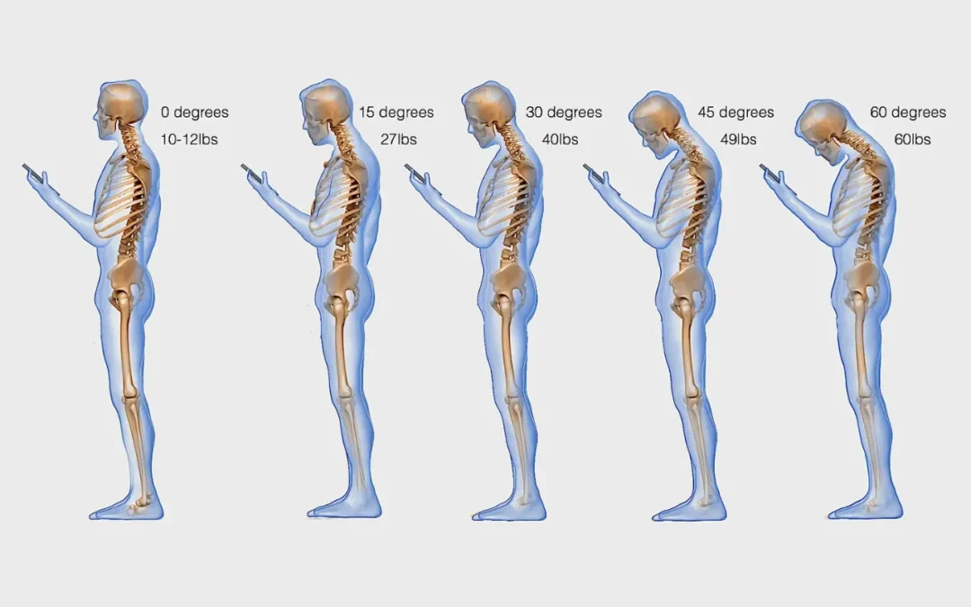 How Smartphones are Affecting Your Spine Health
