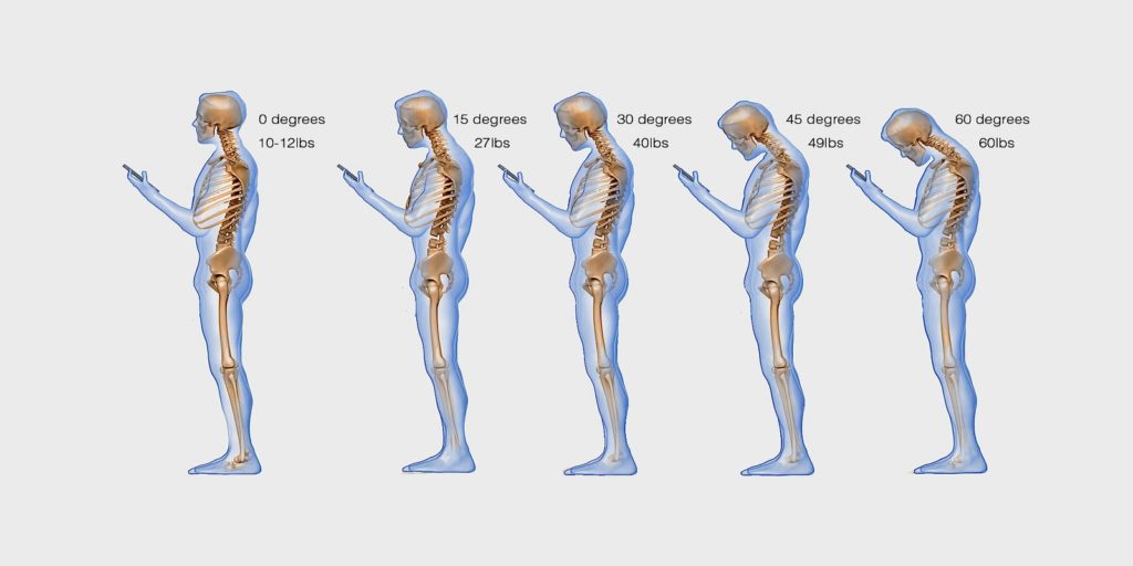 Smartphone Use Is Affecting Your Spine
