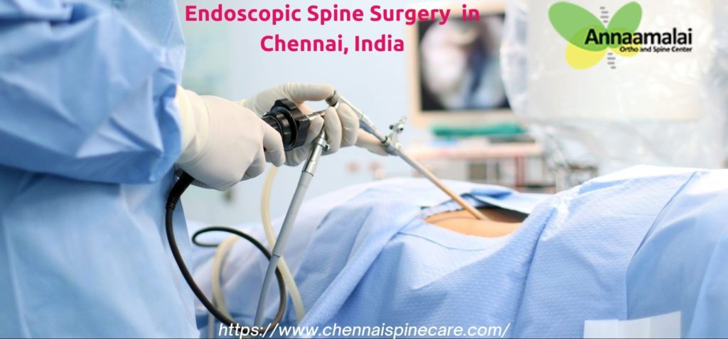 Endoscopic Spinal Surgery Doctors in Chennai