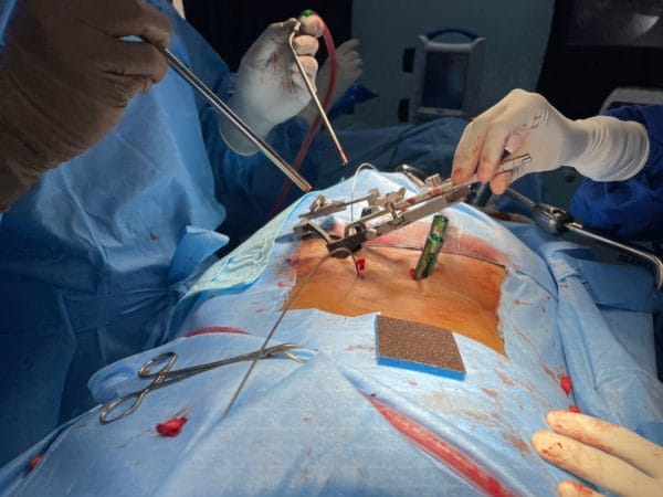 Spine-Surgery-Treatment-600x450-2 Spine-Surgery-Treatment