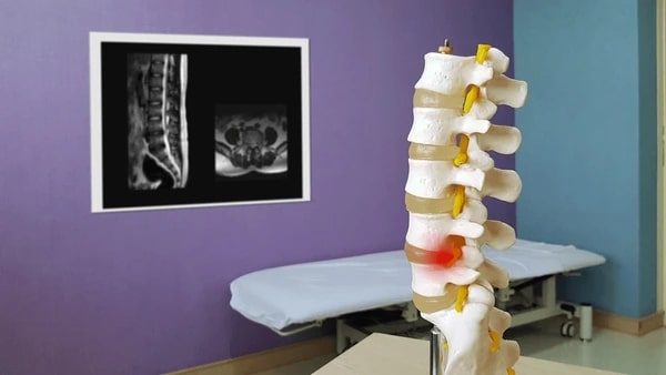 What are Spinal Infections?