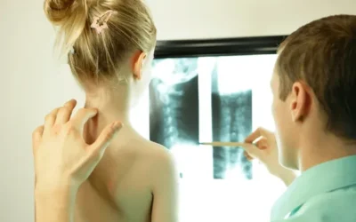 Pediatric Spine Surgery Myths and Facts