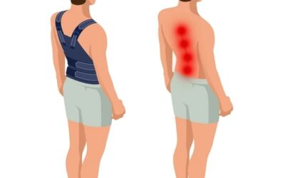 Enhanced Recovery After Spine Surgery