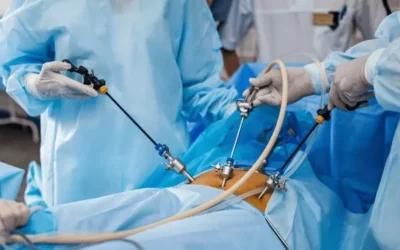 Cost of Endoscopic Discectomy in Chennai vs Other Metros