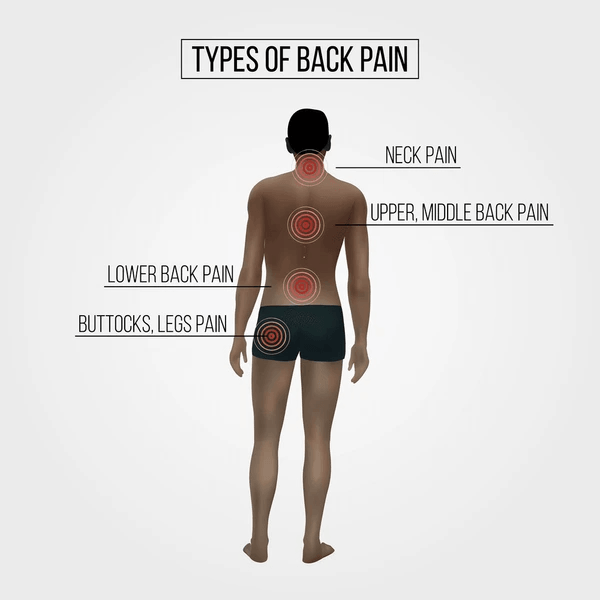 Types of Back Pain
